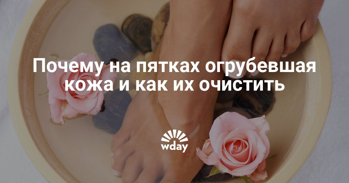 Как в домашних условиях убрать огрубевшую кожу на пятках в домашних условиях Как в домашних условиях убрать огрубевшую кожу на пятках в домашних условиях