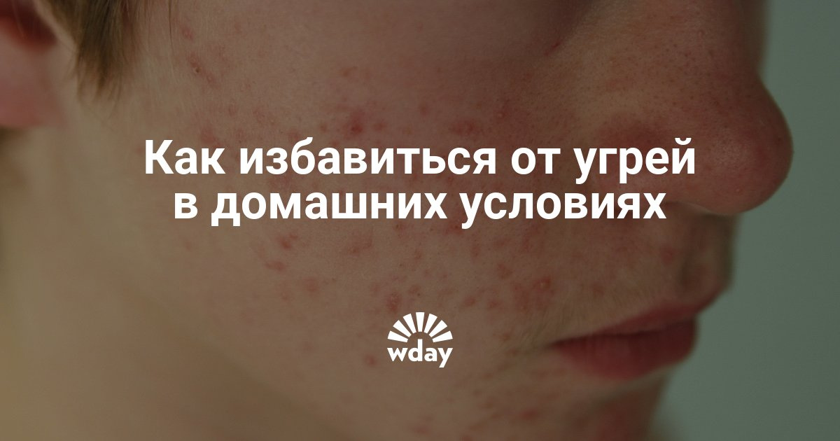 Как избавиться в домашних условиях от следов прыщей Как избавиться в домашних условиях от следов прыщей
