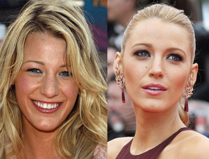 Блейк Лайвли