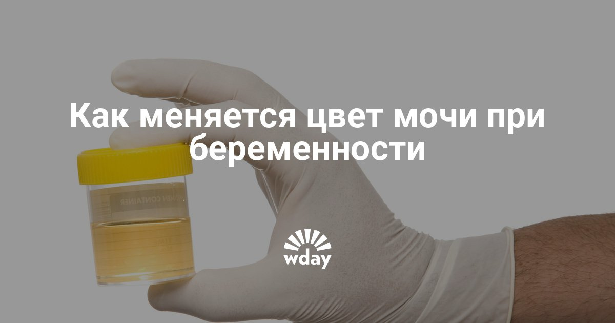 Нормальный цвет мочи у беременной 75