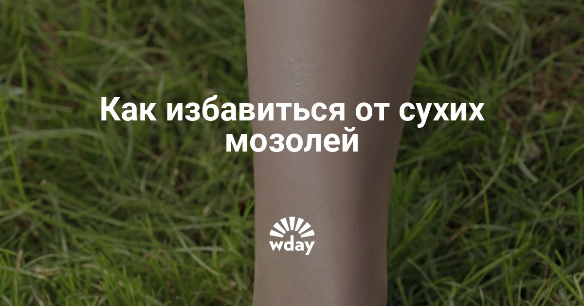 Сухая мозоль на пальце ноги, как избавиться - Woman's Day