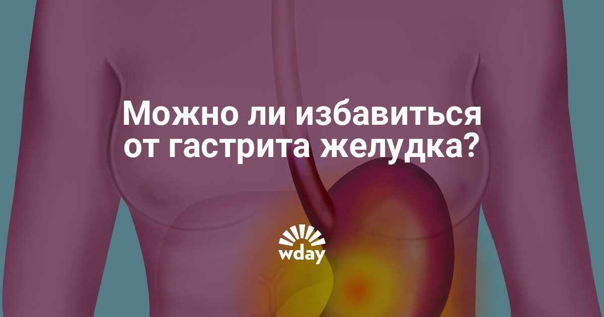 Как вылечить от гастрита в домашних условиях 736 Как вылечить от гастрита в домашних условиях 970