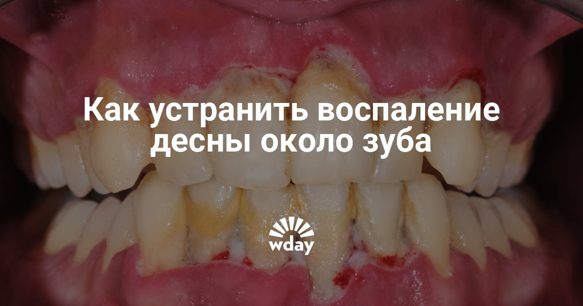 С чем носит ботинки с мехом спортивные С чем носит ботинки с мехом спортивные