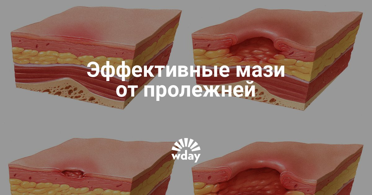 Как сделать мазь от пролежней Как сделать мазь от пролежней