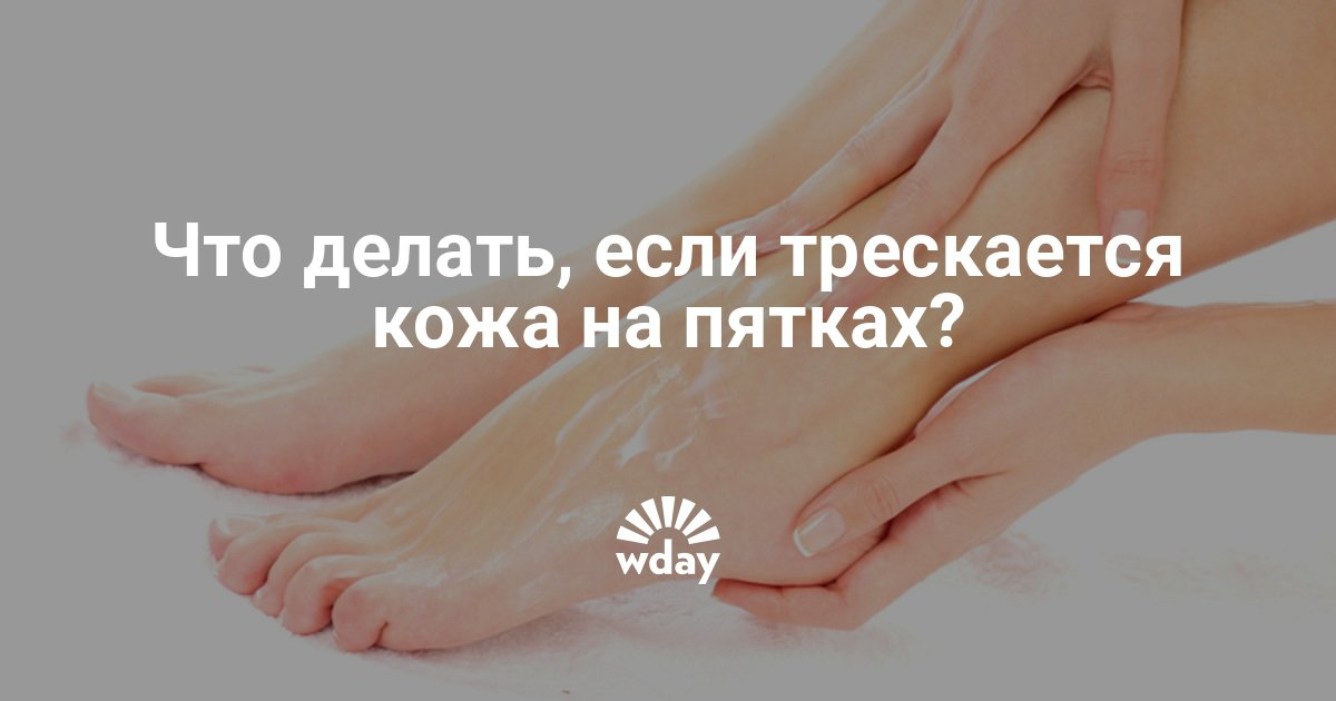 Потрескавшиеся пятки что делать в домашних условиях Потрескавшиеся пятки что делать в домашних условиях
