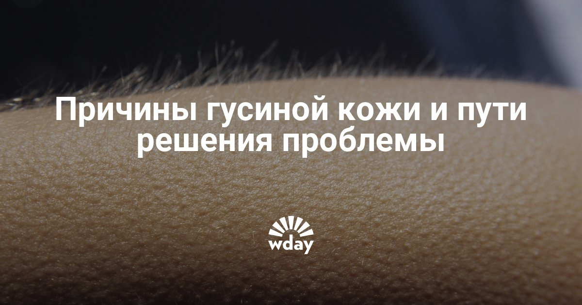 Как вы боритесь с гусиной кожей Как вы боритесь с гусиной кожей