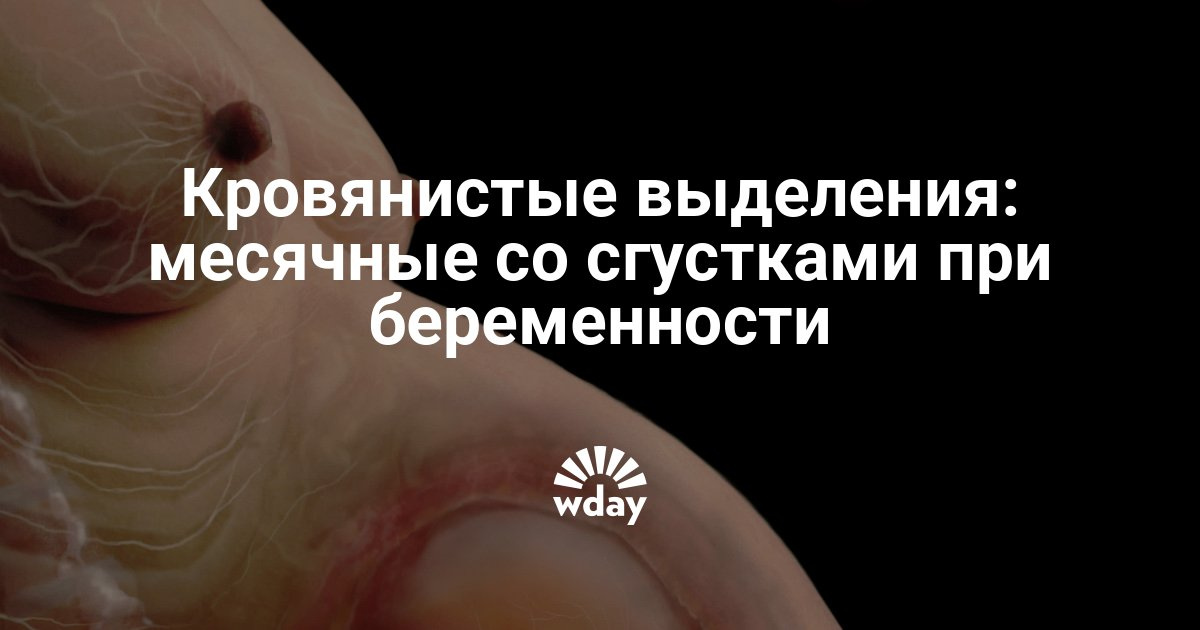 Причины патологических обильных менструаций со сгустками