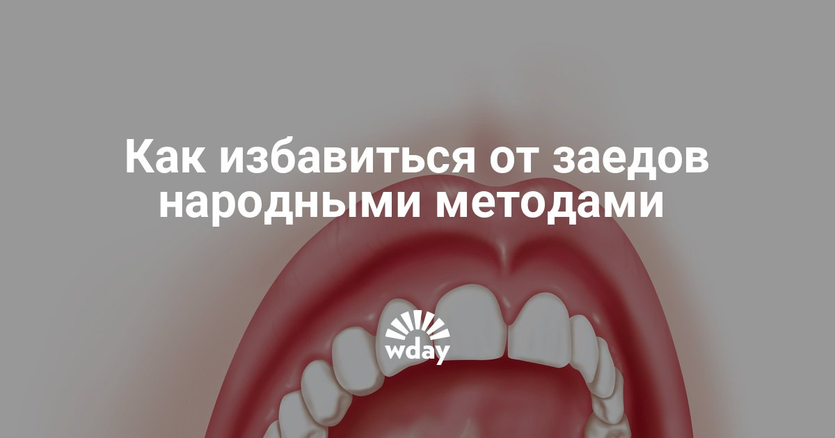 Как быстро избавиться от заедов в уголках губ - Woman's Day
