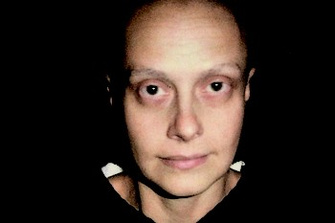 26 сентября 2005. Седьмая химия. Ни ресниц, ни бровей. У меня голое лицо.
