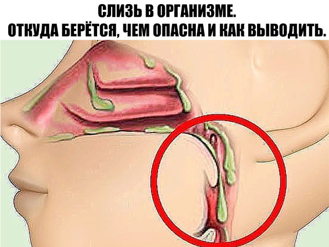 СЛИЗЬ В ОРГАНИЗМЕ. ОТКУДА БЕРЁТСЯ, ЧЕМ ОПАСНА И КАК ВЫВОДИТЬ. СЛИЗЬ В ОРГАНИЗМЕ. ОТКУДА БЕРЁТСЯ, ЧЕМ ОПАСНА И КАК ВЫВОДИТЬ.