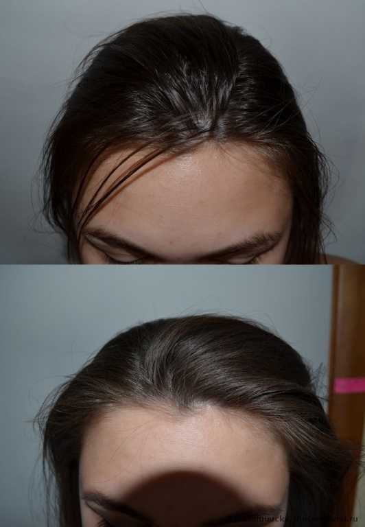 Альтернативный способ мытья головы в наличии) Сухие шампуни PROFFS и FINESSE с природными абсорбентами моментально освежат корни волос, не оставляют налета, придают объем. Это просто находка для девушек) Раздача на следующей неделе Альтернативный способ мытья головы в наличии) Сухие шампуни PROFFS и FINESSE с природными абсорбентами моментально освежат корни волос, не оставляют налета, придают объем. Это просто находка для девушек) Раздача на следующей неделе