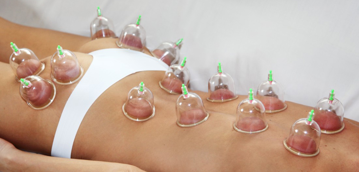 Баночный массаж Баночный массаж