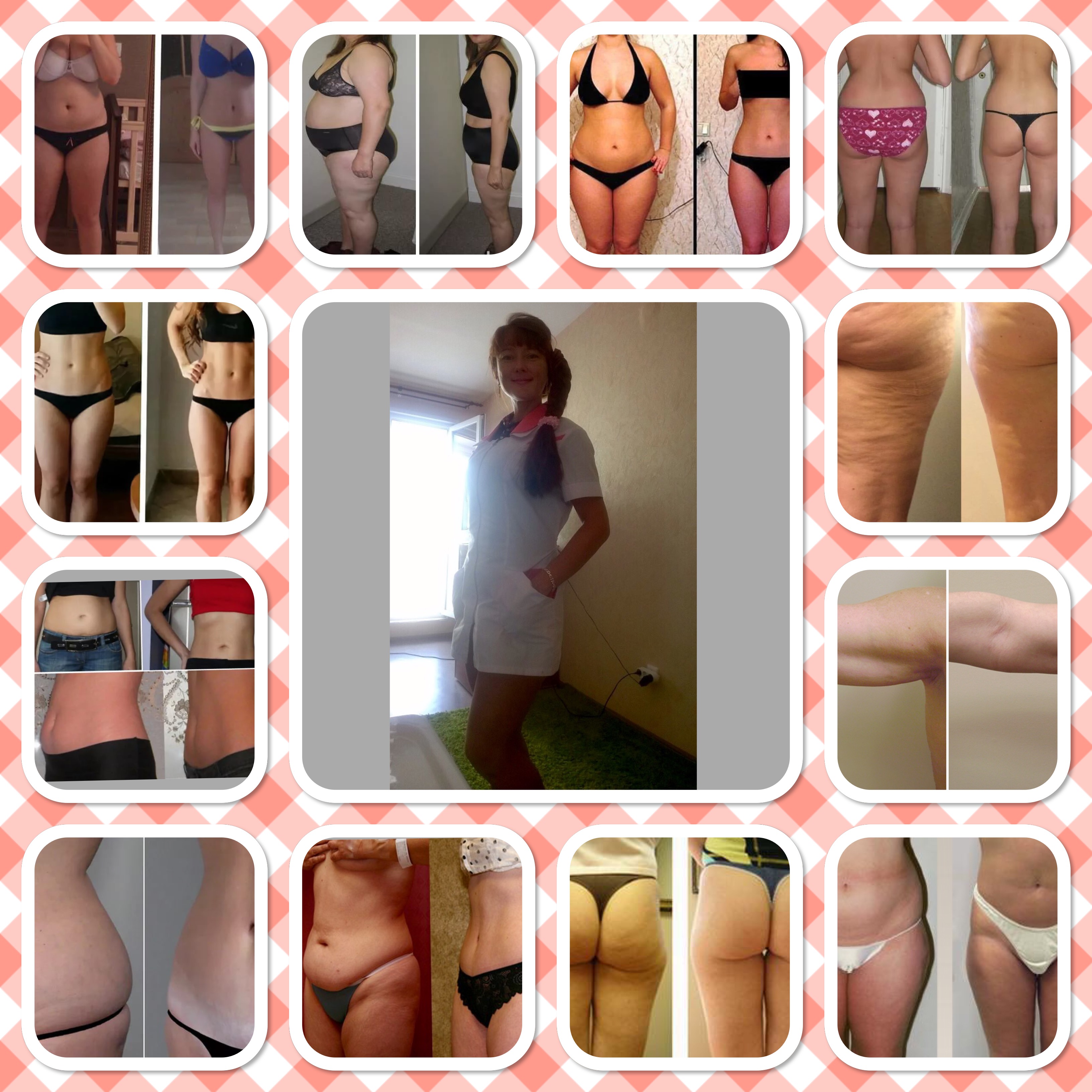 Помощь в избавлении от жировых отложений и целлюлита. Помощь в избавлении от жировых отложений и целлюлита.