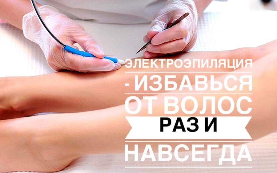 ЭЛЕКТРОЭПИЛЯЦИЯ ЭЛЕКТРОЭПИЛЯЦИЯ