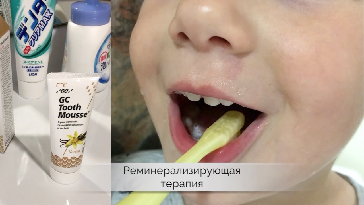 Tooth Mousse. Ниже цена мне ещё не попадалась -- 923р. Tooth Mousse. Ниже цена мне ещё не попадалась -- 923р.