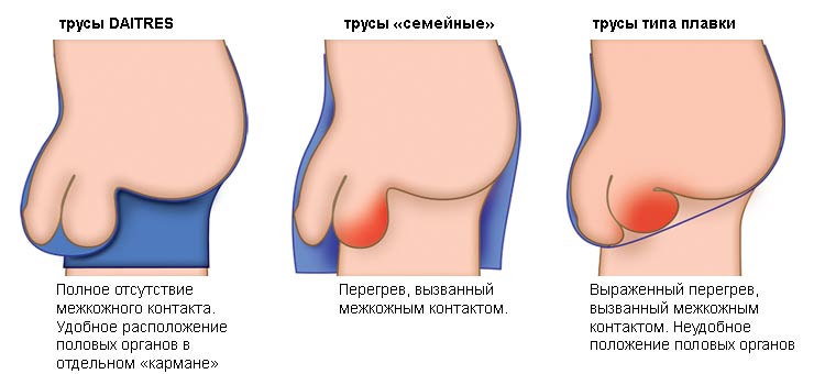 Читали отзывы по трусам "Забота о нем"? Читали отзывы по трусам "Забота о нем"?