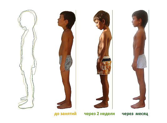Упражнения для правильной осанки Упражнения для правильной осанки
