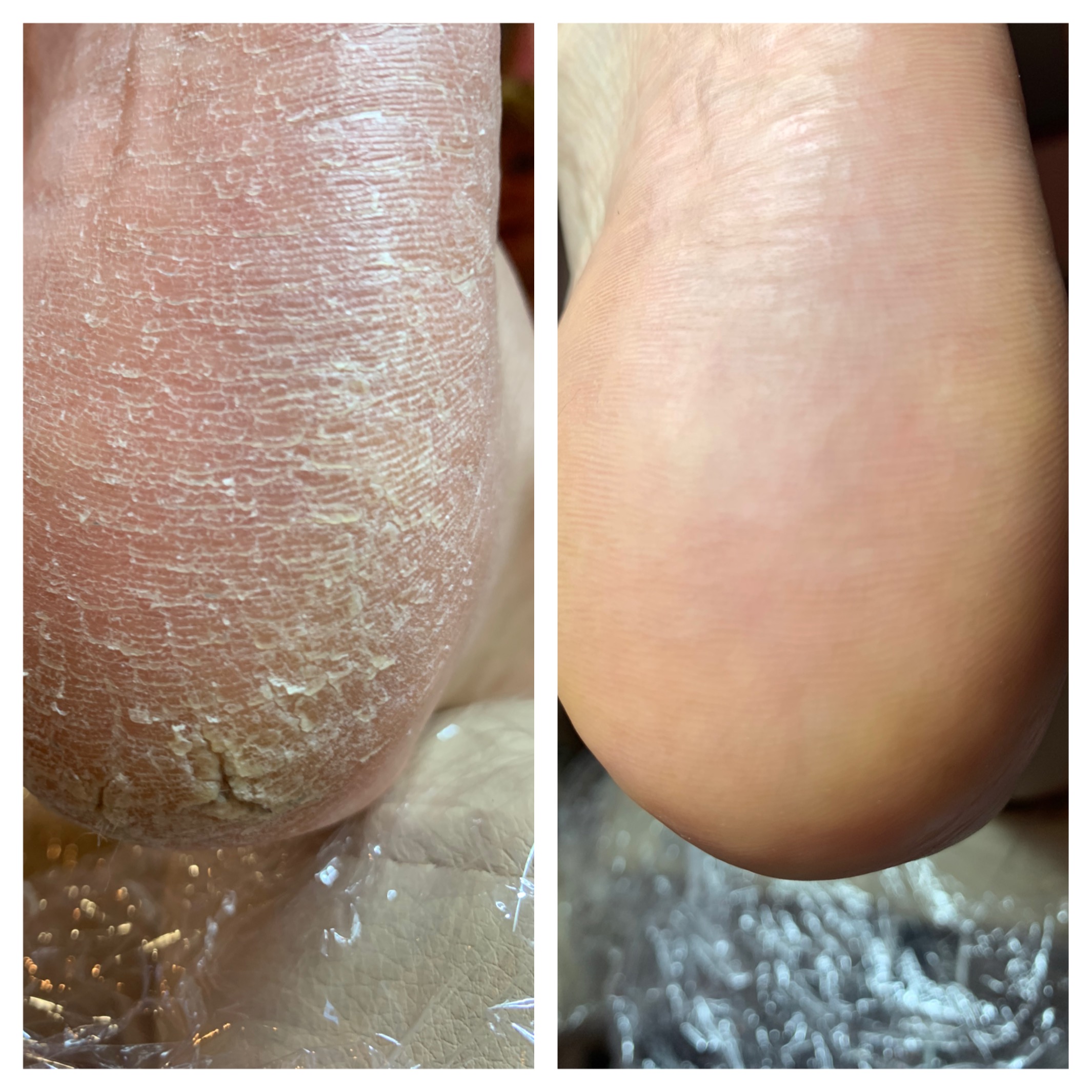 SMART педикюр!!! SMART педикюр!!!