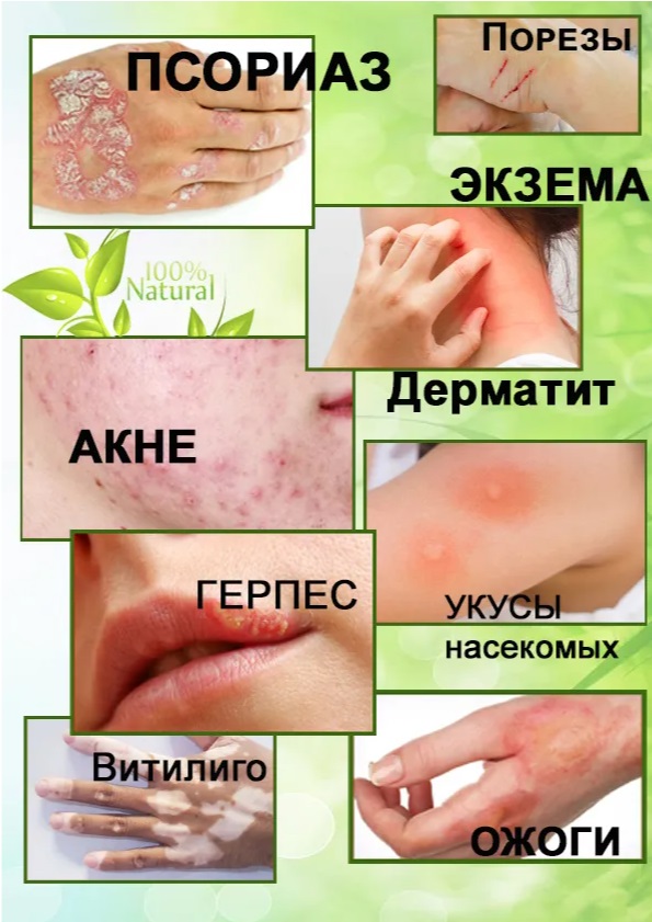 Сбор до 04.07.2022г. БОМБА!!! Распродажа! Китайская чудо-мазь при псориазе и Китайский обезболивающий крем по 99руб! - 3 Сбор до 04.07.2022г. БОМБА!!! Распродажа! Китайская чудо-мазь при псориазе и Китайский обезболивающий крем по 99руб! - 3