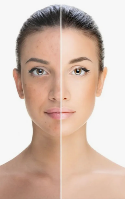 СПЕЦ-ЦЕНА! БЫЛА 829 руб СТАЛА 301 р! Твоя кожа как после салонного пилинга! Специальная обновляющая сыворотка с комплексом кислот (AHA, BHA, PHA) - это идеальная полировка и глубокое преображение твоего лица! СПЕЦ-ЦЕНА! БЫЛА 829 руб СТАЛА 301 р! Твоя кожа как после салонного пилинга! Специальная обновляющая сыворотка с комплексом кислот (AHA, BHA, PHA) - это идеальная полировка и глубокое преображение твоего лица!