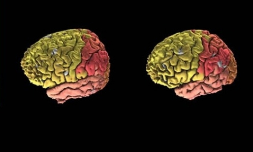 Создан первый полный цифровой атлас мозга