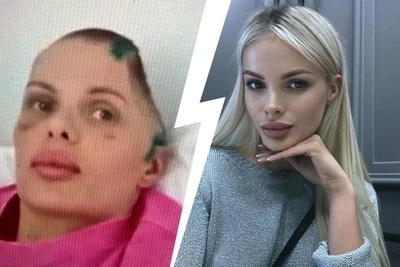 Family of beaten model demands boyfriend be held in custody