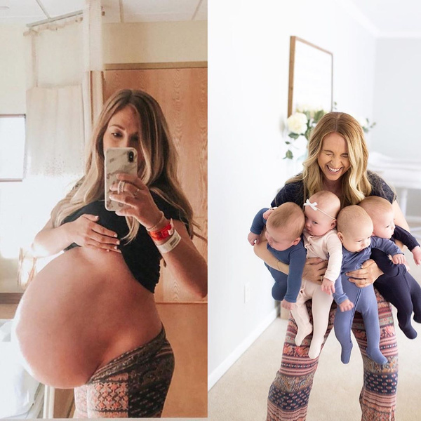 Мама четверни поделилась невероятным фото до и после родов