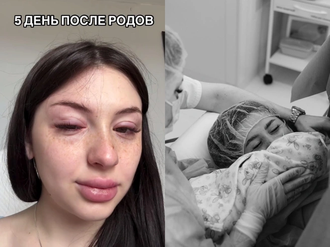 Первая неделя материнства далась ей с трудом | Источник: @aleksa_kotskaya / T.me