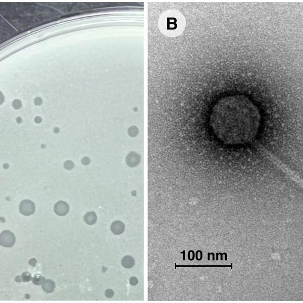 Лабораторная культура бактерии Mycobacterium smegmatis, пораженная микобактериофагом Vic9 | Источник: РНФ