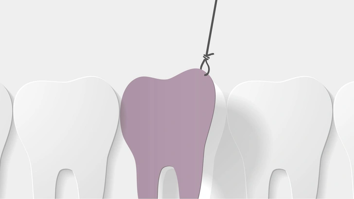 Как вырвать коренной зуб самостоятельно