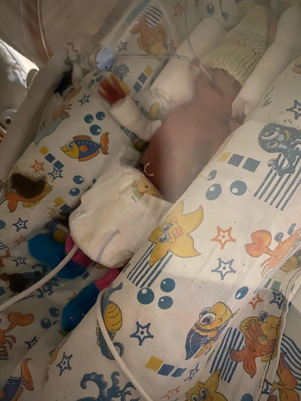 В первые месяцы за Кирилла дышал аппарат ИВЛ, а кормили кроху через зонд | Источник: Елена Куранина