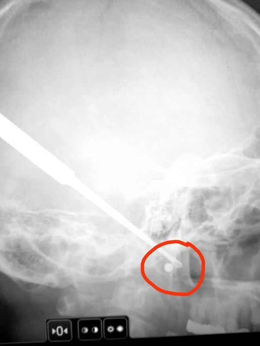 Источник: пресс-служба ГБСМП