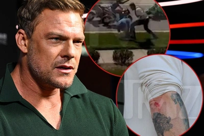 Алан Ричсон отделался легкими травмами в драке