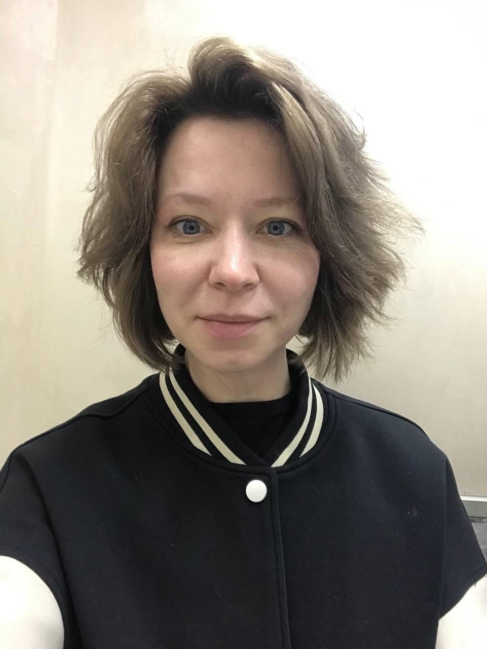 Художница придумала историю про потерянный глаз и онкологию, а сама жила роскошной жизнью на собранные деньги