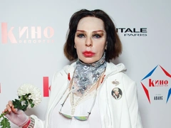 Жанна Агузарова сделала круговую подтяжку, но вышла в свет прежде чем лицо «село»