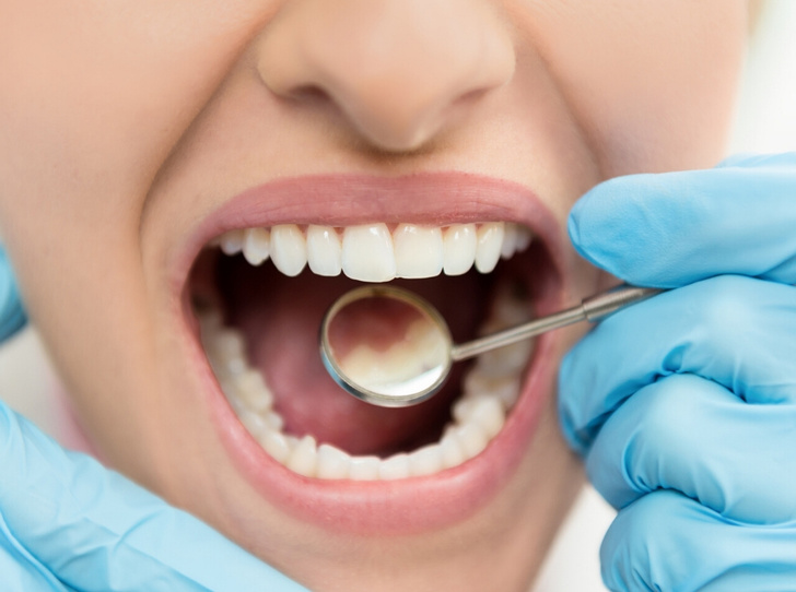 Фото №2 - Мифы и правда об имплантации зубов