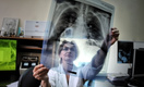 ВОЗ планирует полностью ликвидировать туберкулез в 33 странах мира, но не в России