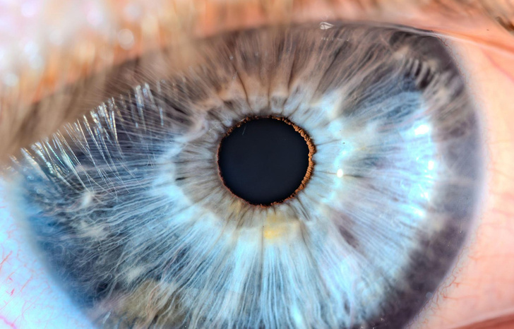 Глаза разных цветов — опасно ли это? Объясняют офтальмологи