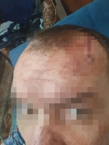 Фото с рассеченной головой было сделано после нападения | Источник: из архива потерпевших