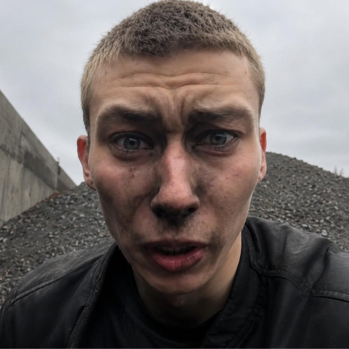 «Даже у обезьян нет таких губ»: врач, обозвавшая пациентку, уволена, парень, ехавший в вагоне с углем после гулянки, наказан