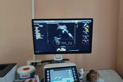 Нижегородка после клинической смерти при родах в вегетативном состоянии