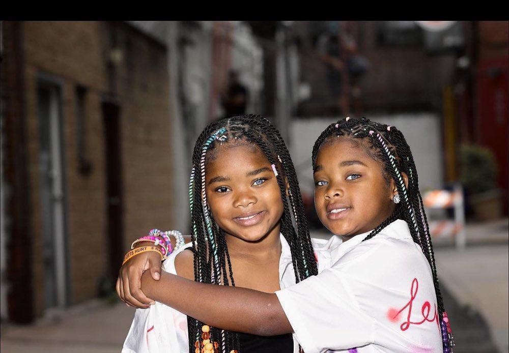 Как сейчас выглядят необычные близняшки с разным цветом глаз | PARENTS