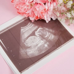 Самые интересные серии шоу «Беременна в 16»: топ-10 эпизодов для просмотра