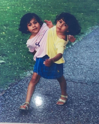 Как живут сиамские близняшки из Мексики, которых мать отказалась разделять
