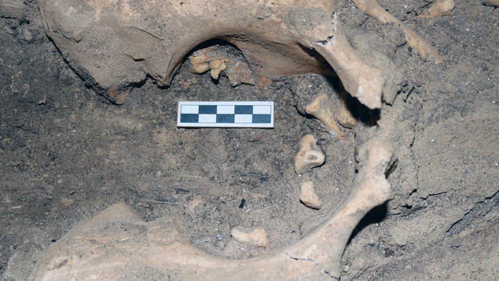 3000-летняя опухоль с зубами: в Египте нашли останки девушки c тератомой