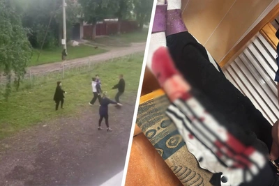 Подросток в Бугульме пострадал от собак: видео очевидцев