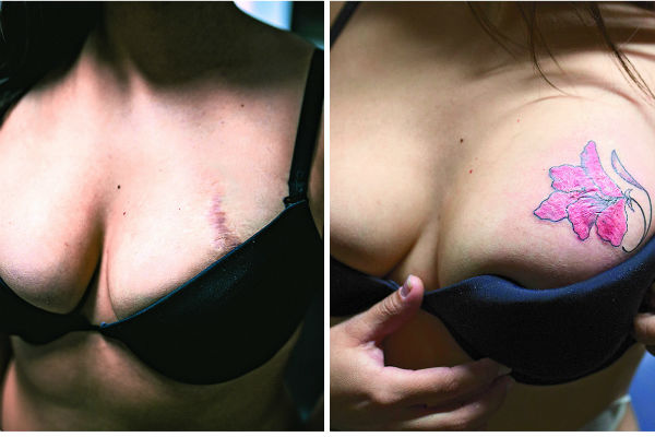 «Чаще всего пострадавшие женщины выбирают две темы для татуировок: цветы – символ женственности и бабочек – как знак перерождения души», - говорит Женя