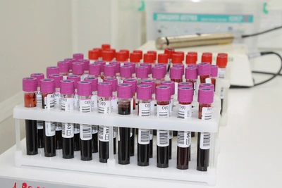 В Пензенской области более 1500 доноров костного мозга