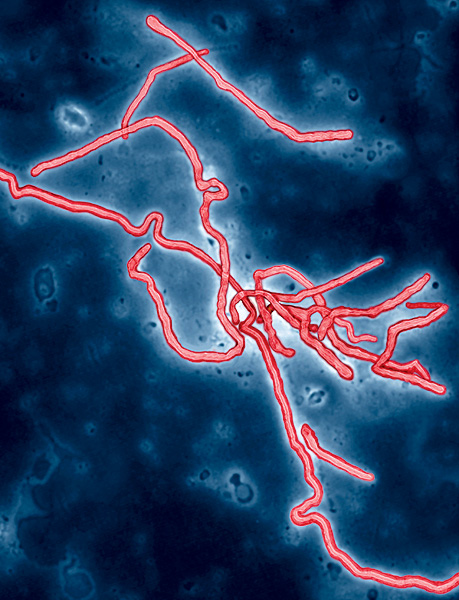 ВОЗ считает неизбежным распространение Эболы в Европе