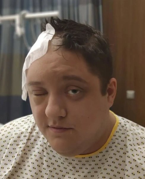 Осенью 2018 года Роману поставили страшный диагноз — «рак мозга». Спустя два года после лечения артист вошел в ремиссию